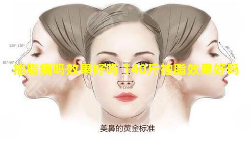 抽脂痛吗效果好吗 140斤抽脂效果好吗
